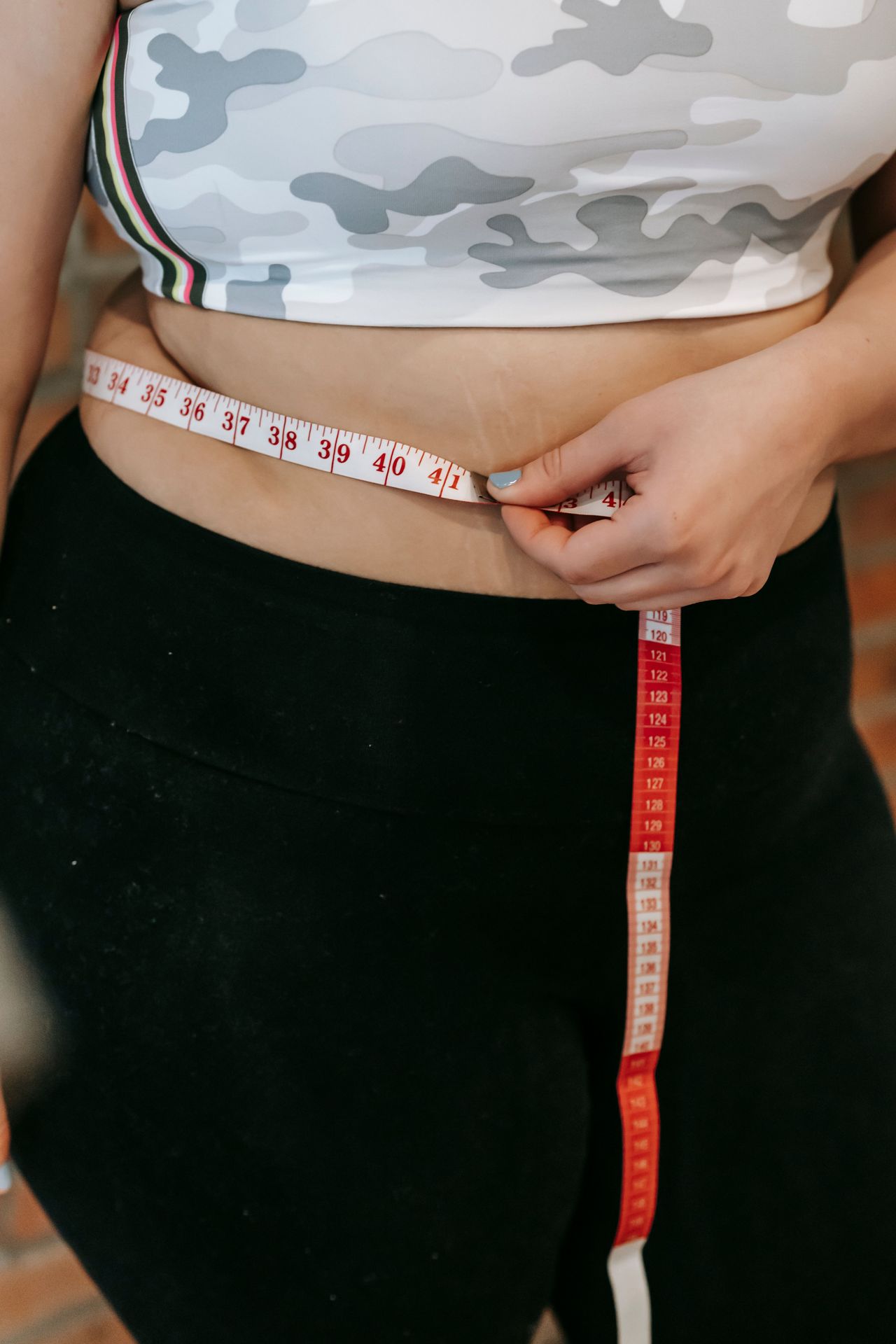 Gastrik Bypass